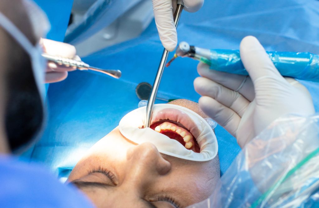 Chirurgie orale et buccale Casablanca Bd Al Qods