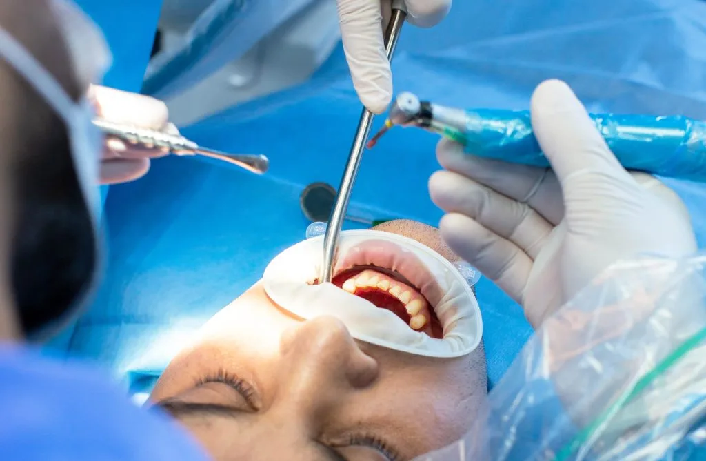 Chirurgie orale et buccale Dr Ibnou Zahir Casablanca